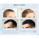 Derma Selo Agulhas Minha loja