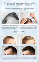 Derma Selo Agulhas Minha loja