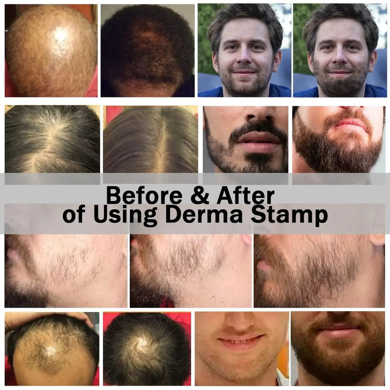 Derma Selo Agulhas Minha loja